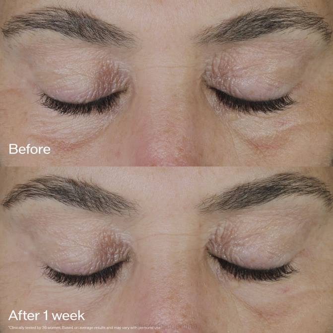 Shiseido crema de ojos revitalizante y reafirmante R8DB48 protección de la piel