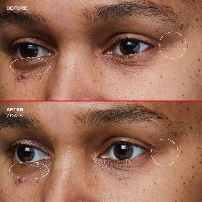 Shiseido crema para ojos suavizante de arrugas R8DB46 protección de la piel